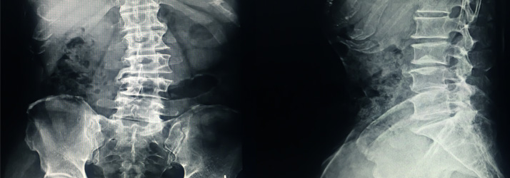 Chiropractic Temecula CA X-Ray